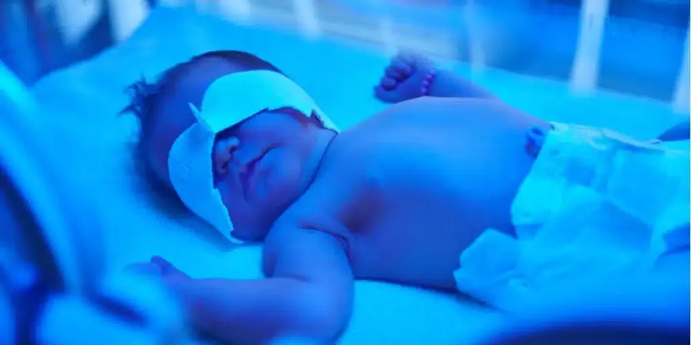 Jaundice in Newborns